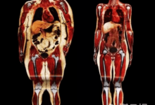 神奇減肥偏方，真的管用嗎？-酷播亮新聞