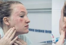 在做射頻緊膚治療后，需要加強面膜補水！-酷播亮新聞