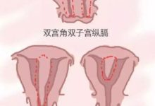 子宮畸形患者可以做試管嬰兒嗎？-酷播亮新聞