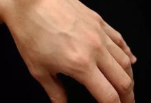手背上凸起的腫塊被我捏癟了，醫生我還有救嗎？-酷播亮新聞