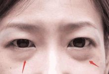 30歲女人有眼袋顯老？范冰冰都用「這種方法」，還能去黑眼圈眼紋-酷播亮新聞