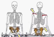 妞蜜骨盆矯正：90%的女性骨盆都是歪的？-酷播亮新聞