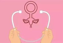 為什麼女人要定期去做宮頸癌篩查？身體出現3個信號，最好要重視-酷播亮新聞