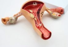 醫生：它是婦科第一癌！現在做5事，女人可以預防-酷播亮新聞