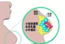 關於 乳腺疾病 三個女性必須知道的常識!-酷播亮新聞