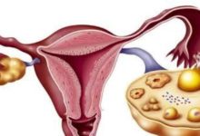 剛過40歲的女性，堅持「3多3少」，卵巢不早衰，絕經不提前