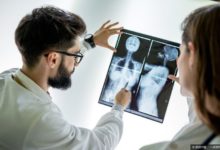 女性如何預防乳腺增生？醫生提醒：重視這4點很有幫助