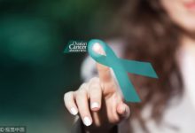 卵巢囊腫，如何選擇治療方式？